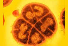 orange/brown bacterium