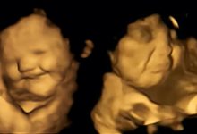 reactions foetus saveurs aliments